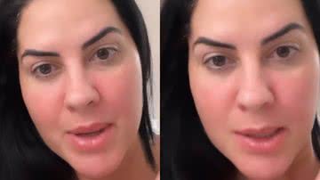 Graciele Lacerda fala sobre preenchimento labial - Reprodução/Instagram