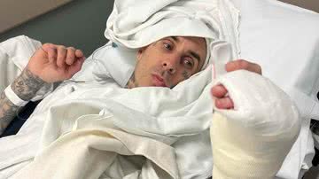 Travis Barker passa por cirurgia no dedo e agradece apoio - Reprodução/Instagram