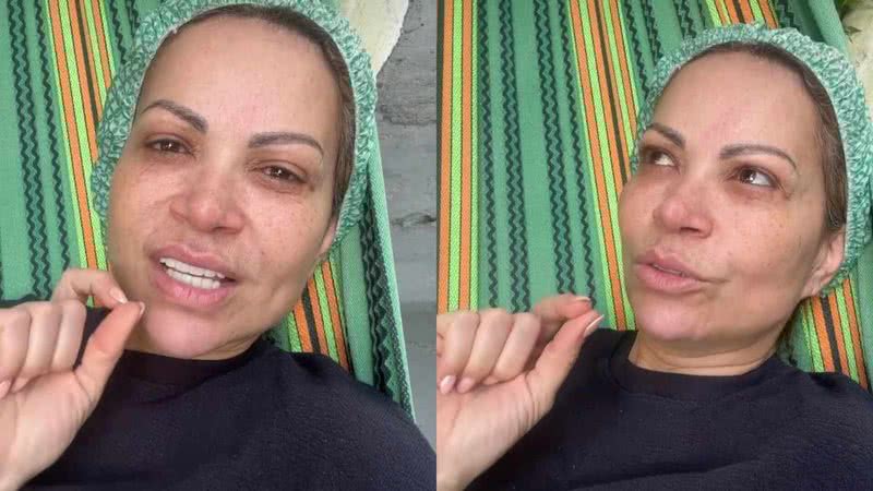 Solange Almeida passa por cirurgia - Reprodução/Instagram