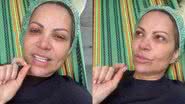Solange Almeida passa por cirurgia - Reprodução/Instagram