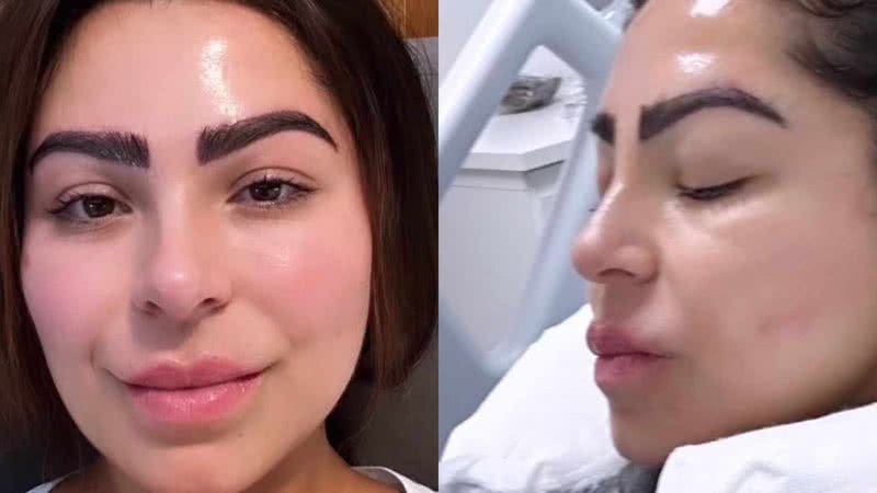Andressa Ferreira choca com transplante de sobrancelha - Reprodução/Instagram