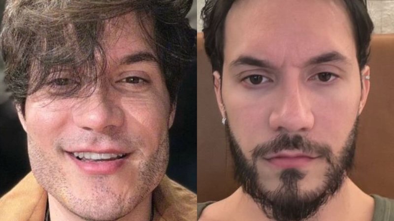 Eliezer antes e depois da reversão da harmonização facial - Reprodução/Instagram