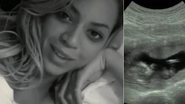 Beyoncé mostra primeira ultrassom de Blue Ivy no documentário 'Life Is But a Dream' - Reprodução/Youtube