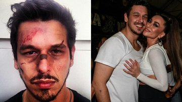 João Vicente, namorado de Sabrina Sato, grava esquete do Porta dos Fundos com rosto machucado- - Reprodução/Instagram e Cláudio Augusto/ Foto Rio News