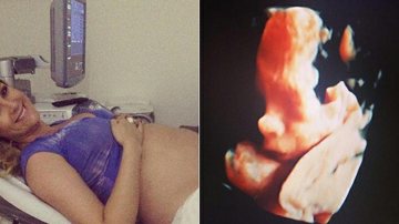 Ana Hickmann mostra ultrassom com o rosto do bebê: "Imagem mais linda do mundo" - Instagram/Reprodução