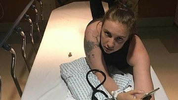 Lena Dunham tropeça nos próprios chinelos e vai parar no hospital - Reprodução Instagram