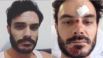 Kiko Pissolato sofre acidente: 'Poderia ter morrido' - Reprodução Instagram