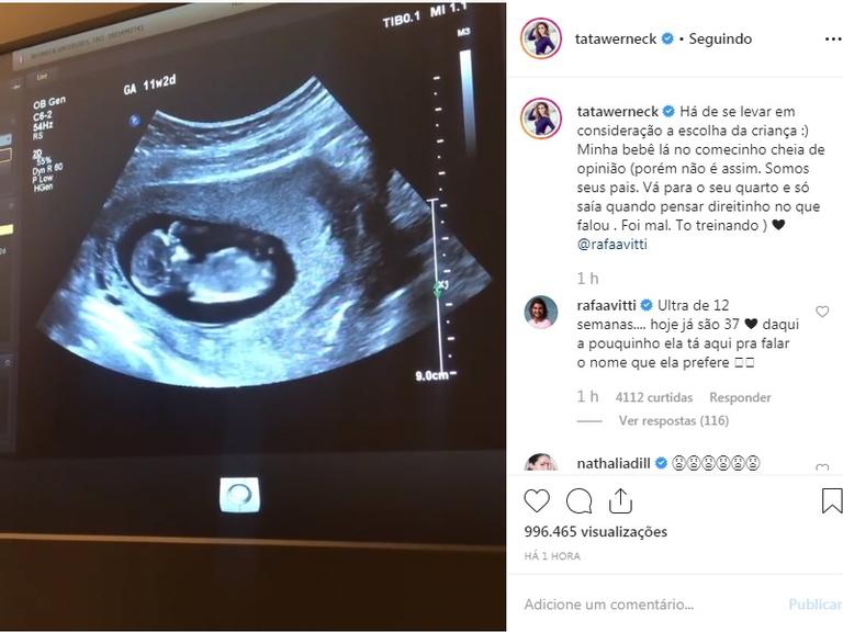 Tatá Werneck compartilhando vídeo de ultrassom da filha com Rafael Vitti