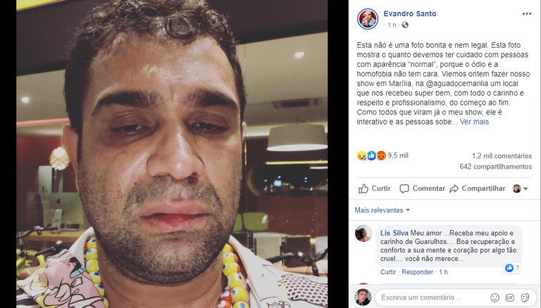Evandro Santo é agredido brutalmente após beijar rapaz durante show no interior de São Paulo