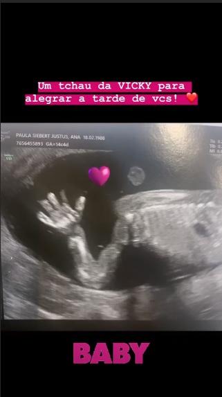 Ana Paula compartilha ultrassom de Vicky, sua primeira filha