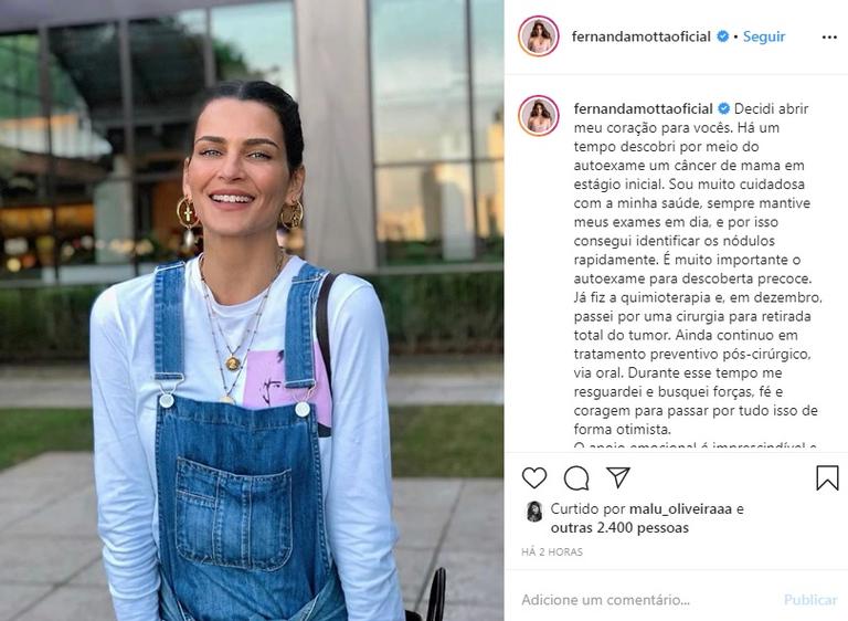Fernanda Motta revela câncer de mama