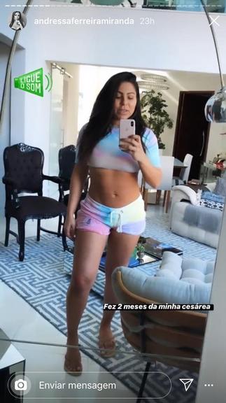 Andressa Ferreira exibe barriga após césarea