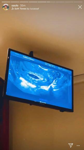 Saulo Poncio mostra ao ultrassom de Gabi Brandt