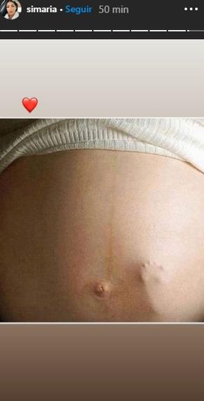 Simaria posta foto de barriga de gravidez e fãs se animam