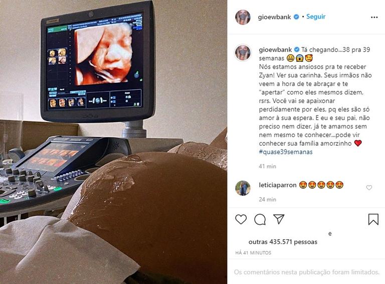 Giovanna Ewbank mostra ultrassom com o rostinho do filho