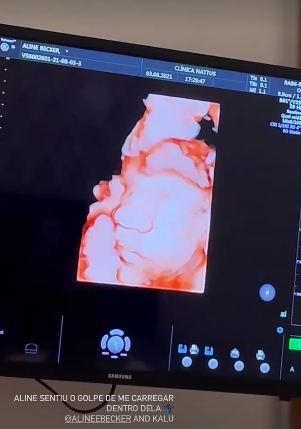 Rafael Zulu se compara com o filho ao mostrar ultrassom do bebê