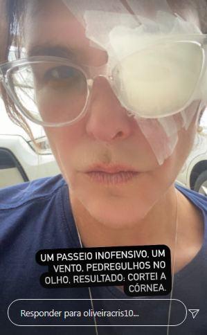 Cristiana Oliveira se machuca durante passeio 
