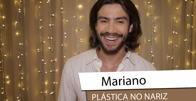 Mariano revela já ter feito plástica no nariz