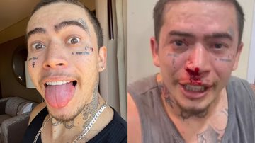 Whindersson Nunes machuca o rosto durante treino de luta - Reprodução/Instagram