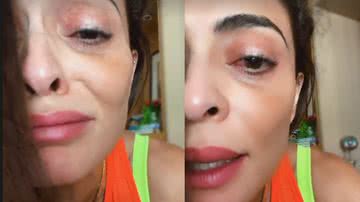 Juliana Paes surge com o olho inflamado - Foto: Reprodução / Instagram
