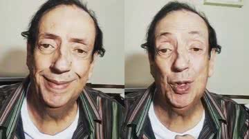 Marcos Oliveira, o Beiçola, revela que passará por cirurgia - Reprodução/Instagram