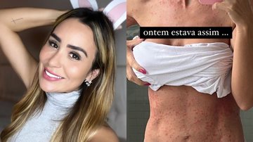 Ex-BBB Letícia Santiago mostra corpo inflamado - Foto: Reprodução / Instagram