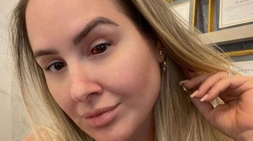 Patrícia Leitte fala sobre seu derrame ocular - Reprodução/Instagram