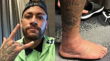 Neymar mostra tornozelo durante tratamento contra lesão - Reprodução/Instagram