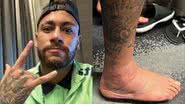 Neymar mostra tornozelo durante tratamento contra lesão - Reprodução/Instagram