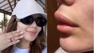 Eslovênia Marques surge com os lábios inchados após crise alérgica - Divulgação/Instagram
