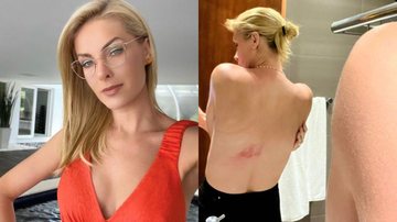 Ana Hickmann machucou as costas e a costela ao cair de cavalo - Reprodução: Instagram