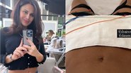 Viviane Araújo mostra tratamento na barriga após o nascimento de Joaquim - Reprodução/Instagram
