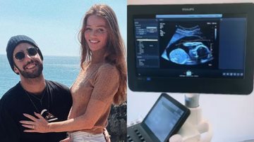 Pedro scooby compartilha ultrassom da filha com Cintia Dicker - Reprodução/Instagram