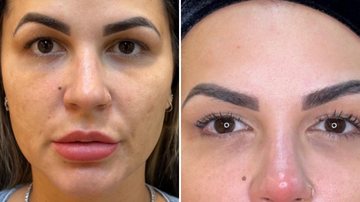 Mudança total! Deolane Bezerra surge após nova harmonização facial: "Refinamento" - Reprodução/ Instagram