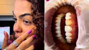 Ex-BBB Paula Freitas coloca lentes de contato nos dentes - Foto: Reprodução / Instagram