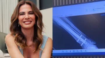 Luciana Gimenez fará nova cirurgia após acidente de esqui - Reprodução/Instagram