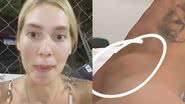 Virginia Fonseca se acidente e mostra machucado - Reprodução/Instagram