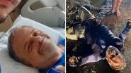 Marcos Breda enfrenta calvário e passa pela sexta cirurgia: "Viver sem dor" - Reprodução/ Instagram