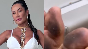 Scheila Carvalho choca ao mostrar pés imundos após Carnaval - Reprodução/Instagram