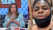 A apresentadora Sonia Abrão advertiu a cantora sobre cirurgia estética durante programa ao vivo - Foto: Reprodução/Instagram