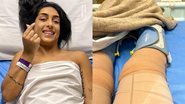 Amanda Djehdian passa por cirurgia nas pernas - Reprodução/Instagram