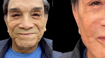 Aos 86 anos, Dedé Santana surpreende ao fazer harmonização facial - Reprodução/Instagram