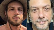 Pai de Chay Suede, Roobertchay Rocha, choca seguidores ao mostrar resultado de rejuvenescimento facial - Foto: Reprodução/Instagram