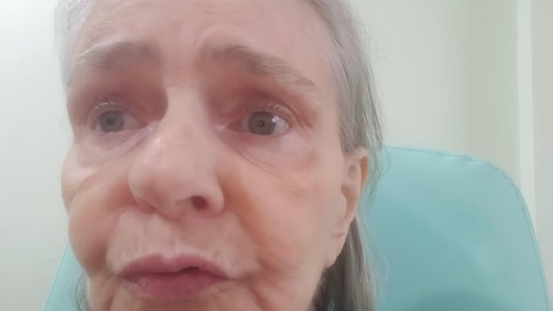 Angela Ro Ro assusta fãs com vídeo em hospital: "Espero estar bem" - Reprodução/ Instagram