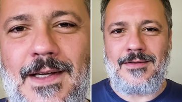 Danton Mello nega cura após diagnóstico de doença: "Não tem" - Reprodução/ TV Globo