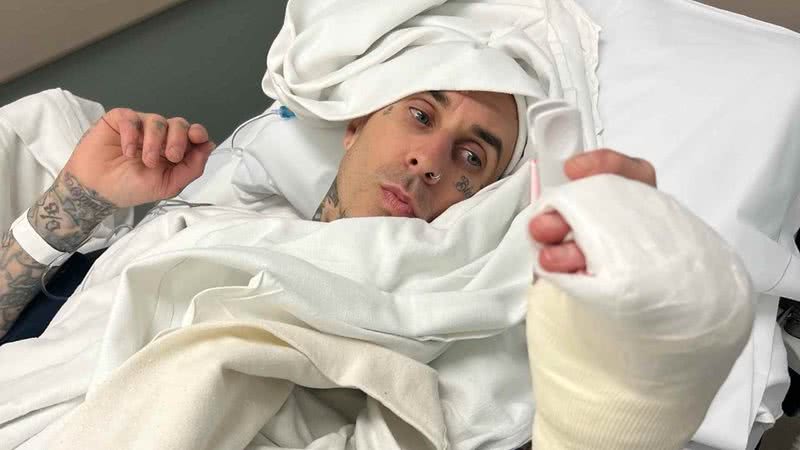 Travis Barker passa por cirurgia no dedo e agradece apoio - Reprodução/Instagram