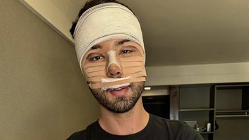 Rico Melquiades em foto após a cirurgia plástica - Foto: Reprodução / Instagram
