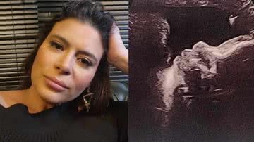 Jornalista Michelle Loreto revela susto durante a gravidez - Reprodução/Instagram