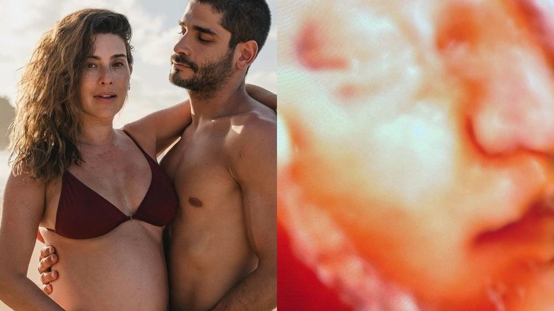 Noivo de Fernanda Paes Leme mostra o rostinho da filha em ultrassom - Reprodução/Instagram/Carol Sábio