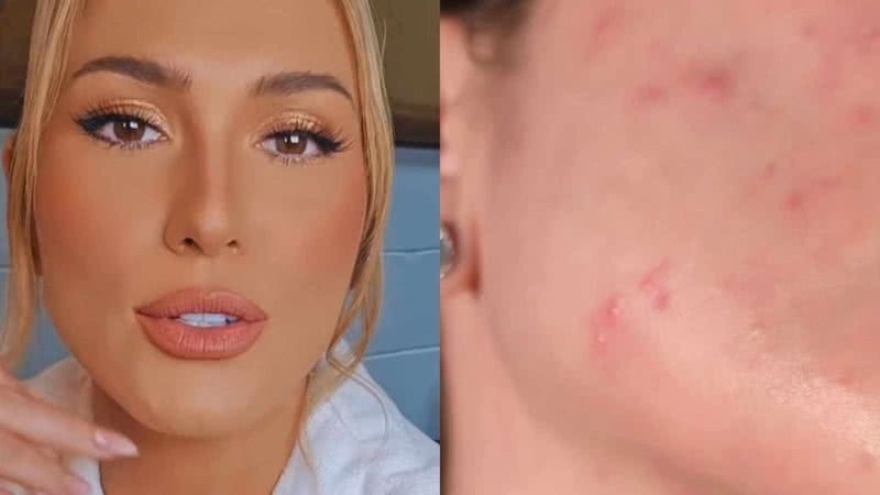 Lívia Andrade tira a maquiagem e choca com situação de seu rosto - Reprodução/Instagram